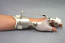 wrist driven prehension orthosis(tenodesis splint) 이미지