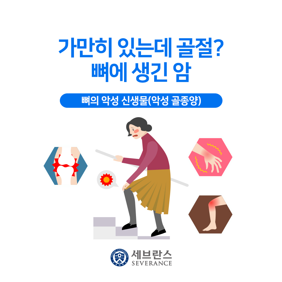 가만히 있는데 골절? 뼈에 생긴 암 - 악성 골종양