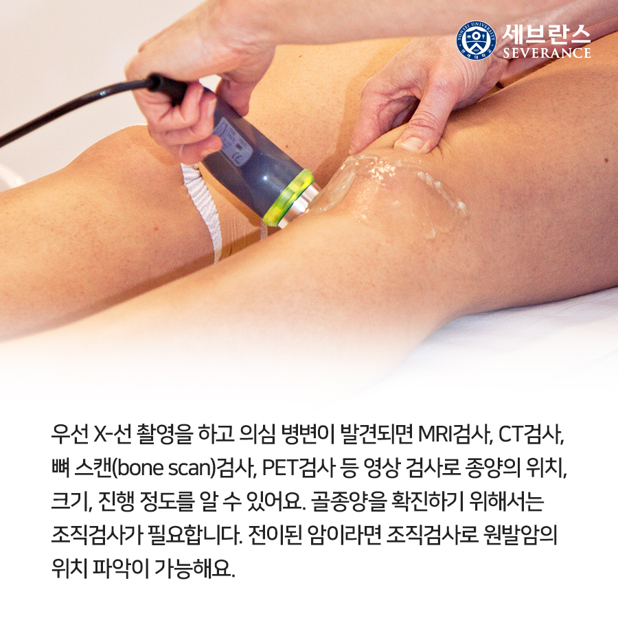 우선 X-선 촬영을 하고 의심 병변이 발견되면 MRI검사, CT검사, 뼈 스캔(bone scan)검사, PET검사 등 영상 검사로 종양의 위치, 크기, 진행 정도를 알 수 있어요. 골종양을 확진하기 위해서는 조직검사가 필요합니다. 전이된 암이라면 조직검사로 원발암의 위치 파악이 가능해요.