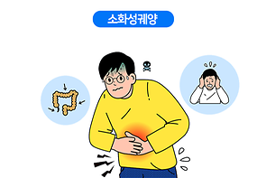 소화성궤양