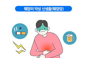 췌장암