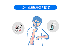급성 림프모구성 백혈병
